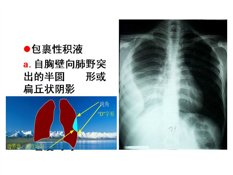 常见影像病例读片汇总