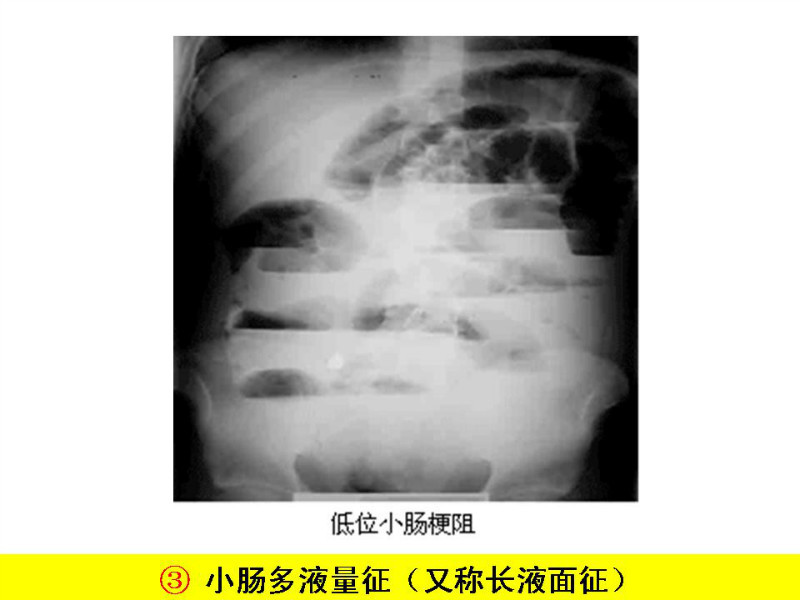 常见影像病例读片汇总
