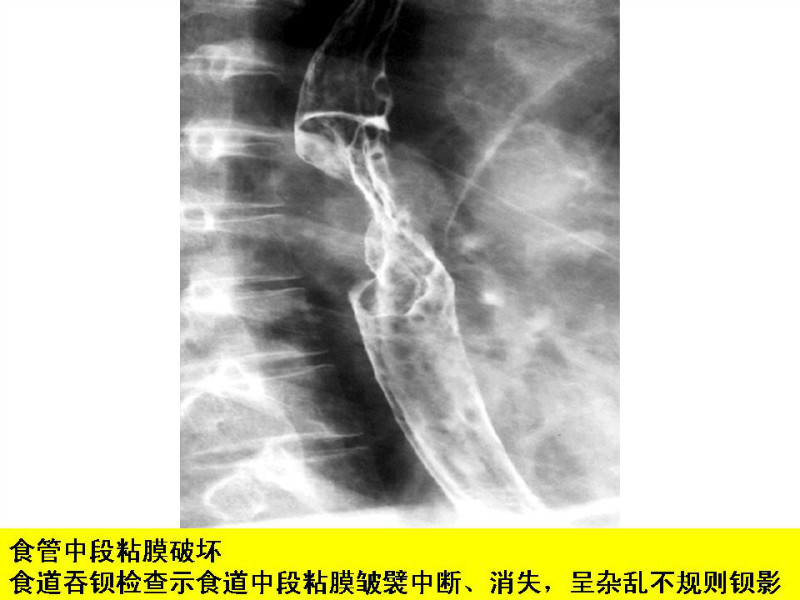 常见影像病例读片汇总