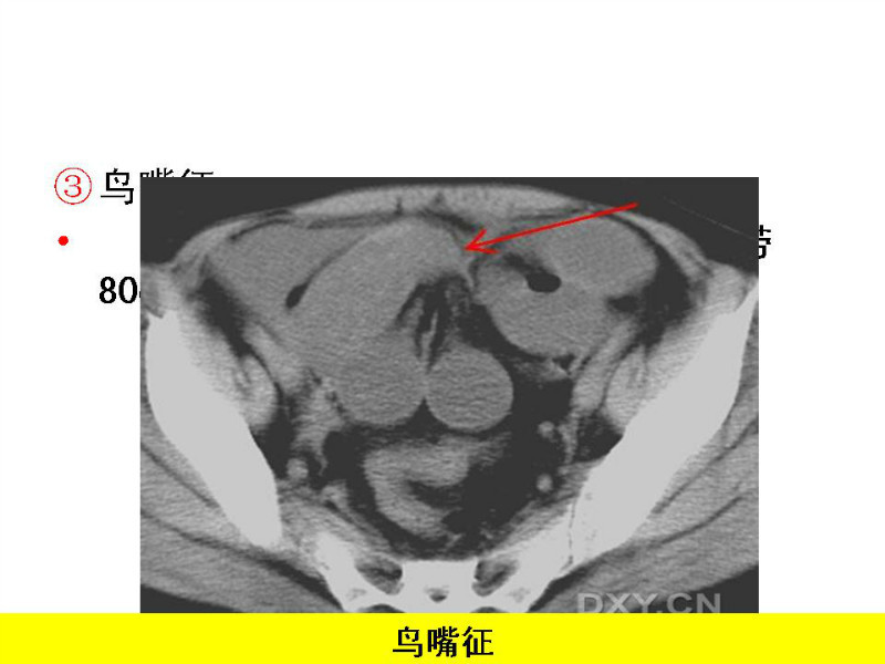 常见影像病例读片汇总