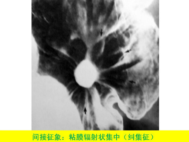 常见影像病例读片汇总