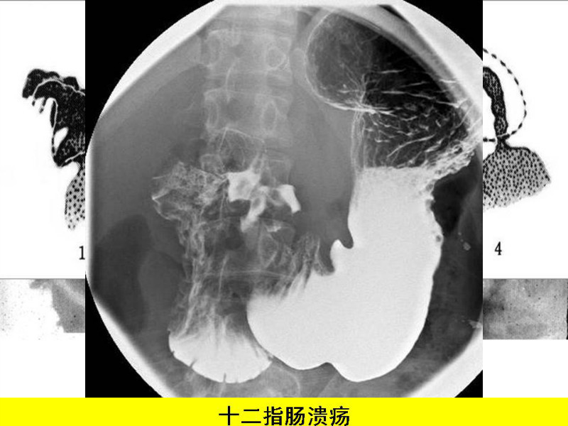 常见影像病例读片汇总