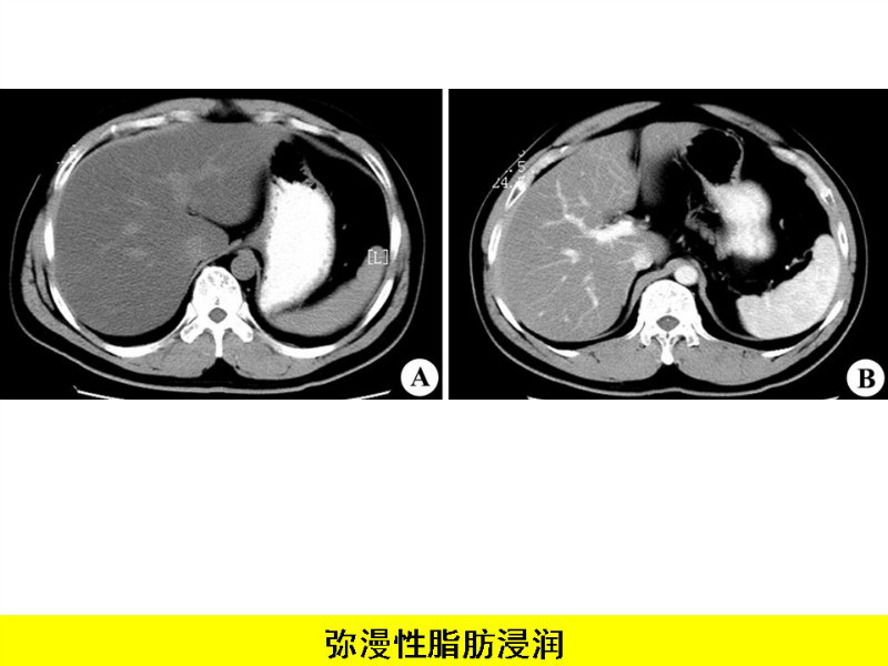常见影像病例读片汇总