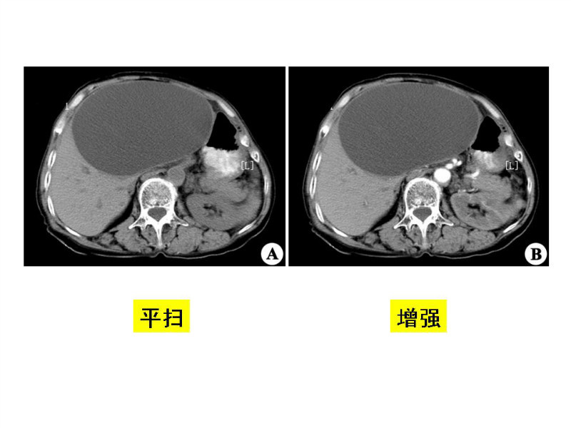 常见影像病例读片汇总
