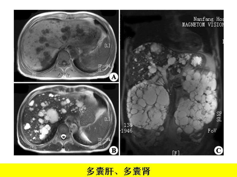 常见影像病例读片汇总