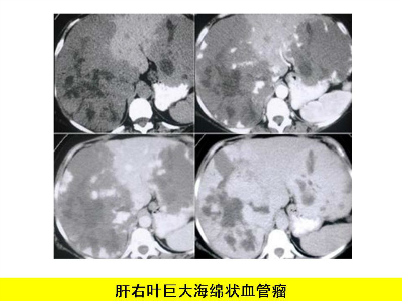 常见影像病例读片汇总