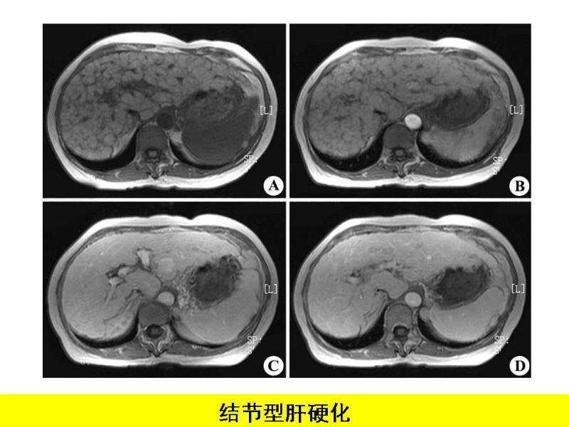 常见影像病例读片汇总