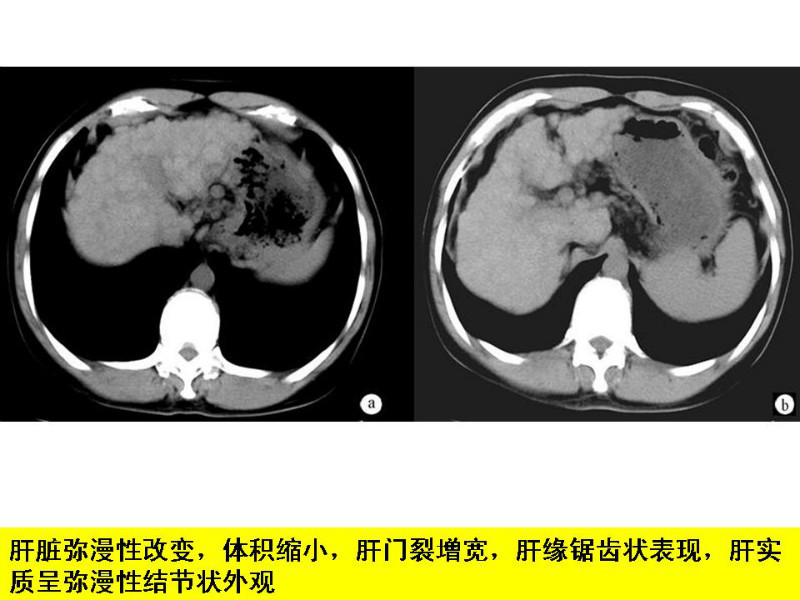 常见影像病例读片汇总