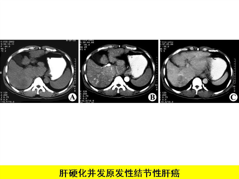 常见影像病例读片汇总