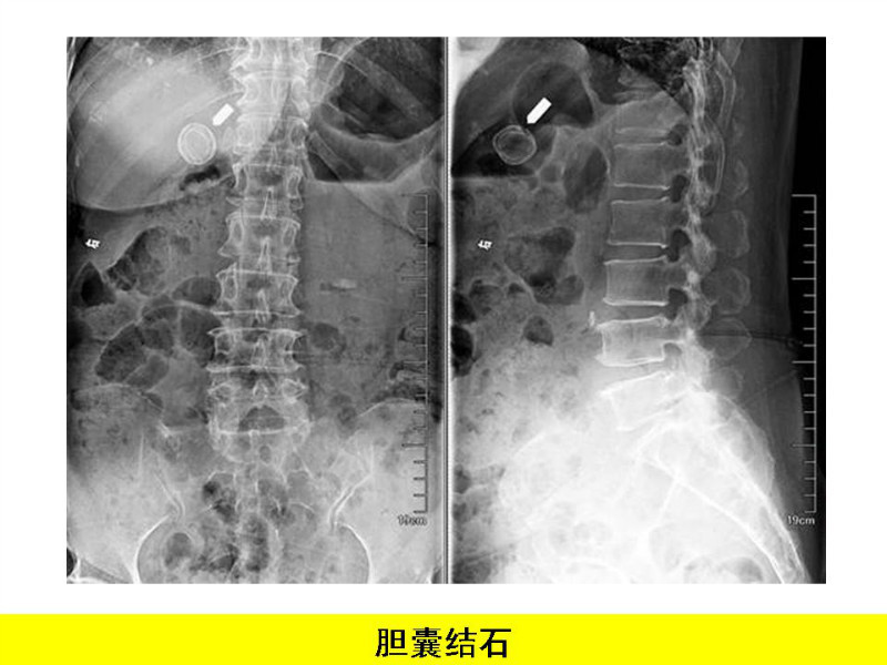 常见影像病例读片汇总