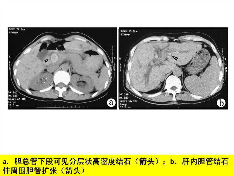 常见影像病例读片汇总