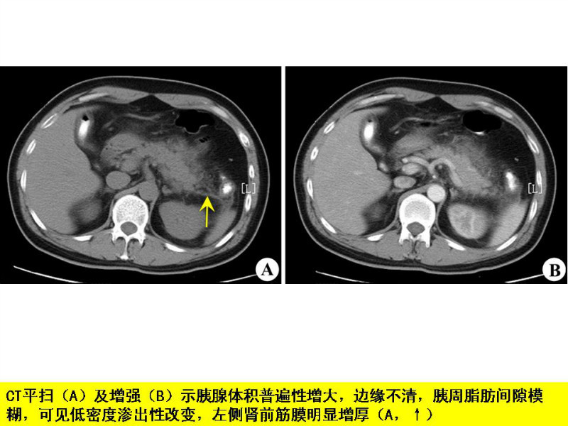 常见影像病例读片汇总