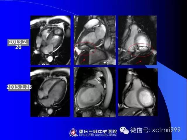 【PPT】心脏MRI及直肠高分辨技术