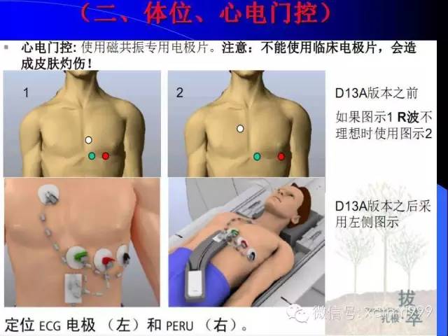 【PPT】心脏MRI及直肠高分辨技术