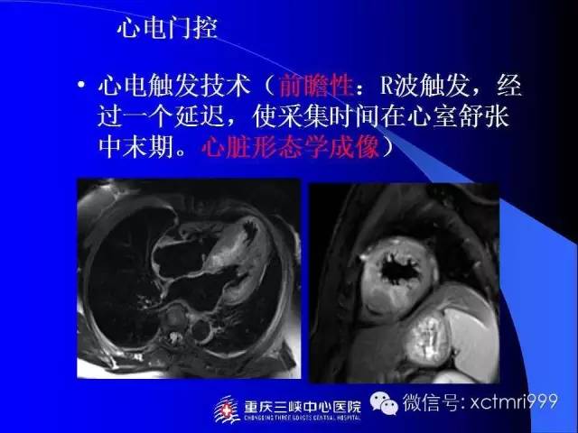 【PPT】心脏MRI及直肠高分辨技术