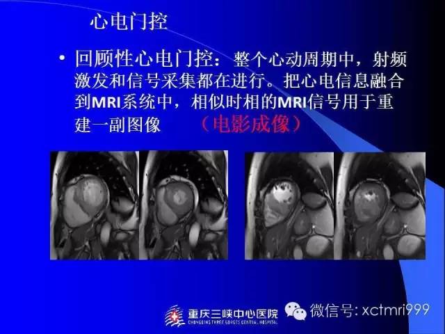 【PPT】心脏MRI及直肠高分辨技术