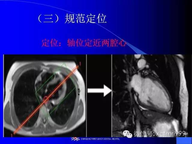 【PPT】心脏MRI及直肠高分辨技术