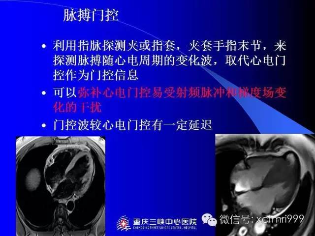 【PPT】心脏MRI及直肠高分辨技术