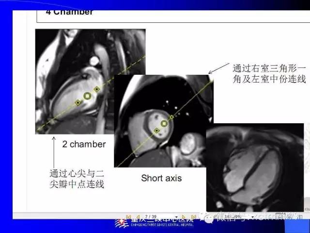 【PPT】心脏MRI及直肠高分辨技术