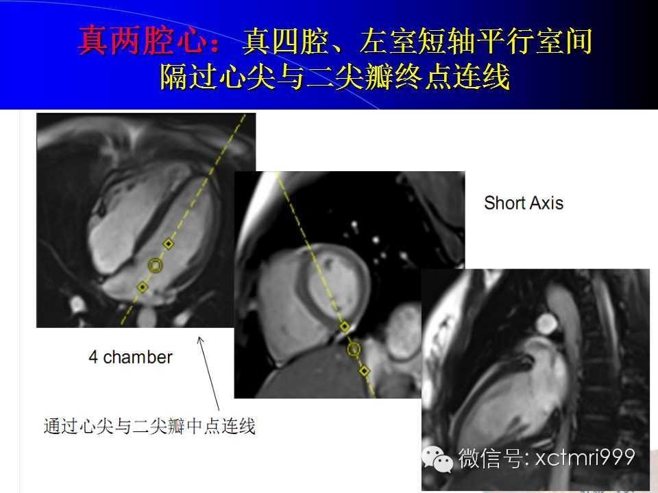 【PPT】心脏MRI及直肠高分辨技术