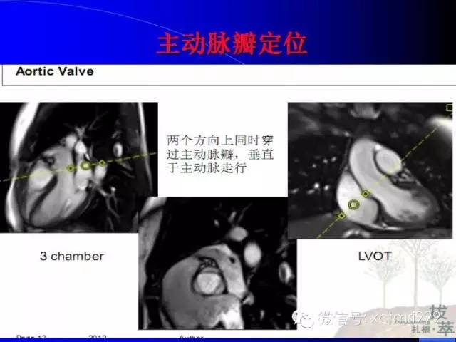 【PPT】心脏MRI及直肠高分辨技术