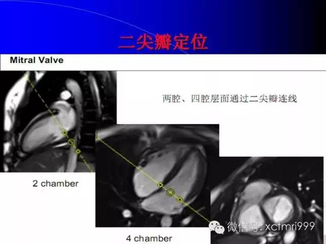 【PPT】心脏MRI及直肠高分辨技术