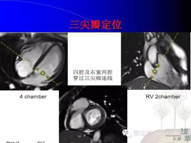 【PPT】心脏MRI及直肠高分辨技术