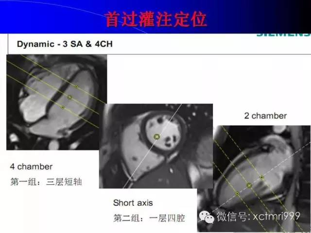 【PPT】心脏MRI及直肠高分辨技术