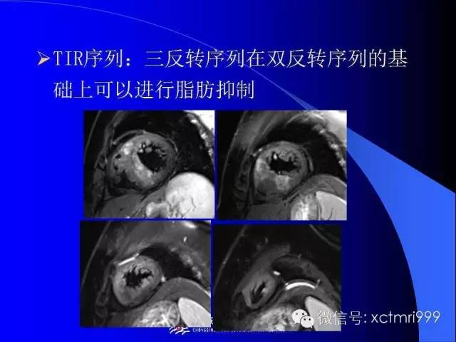 【PPT】心脏MRI及直肠高分辨技术