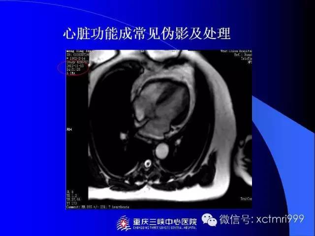 【PPT】心脏MRI及直肠高分辨技术