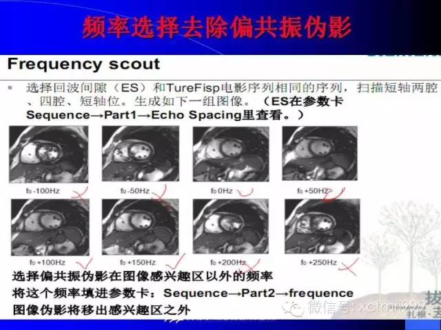 【PPT】心脏MRI及直肠高分辨技术