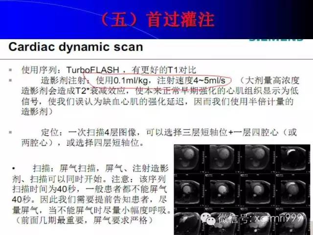 【PPT】心脏MRI及直肠高分辨技术