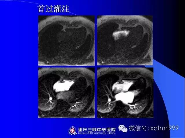 【PPT】心脏MRI及直肠高分辨技术