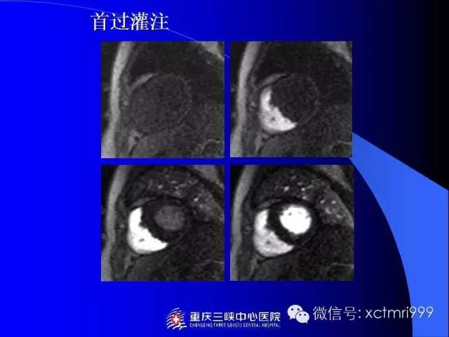 【PPT】心脏MRI及直肠高分辨技术