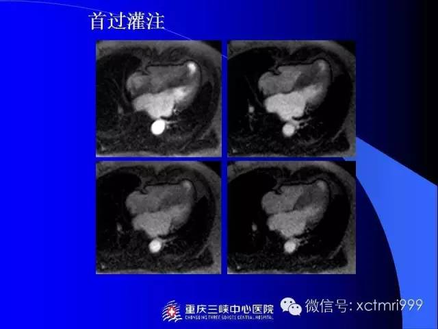 【PPT】心脏MRI及直肠高分辨技术