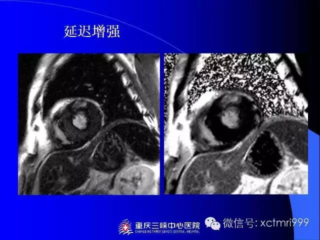【PPT】心脏MRI及直肠高分辨技术