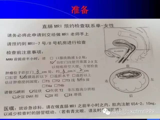 【PPT】心脏MRI及直肠高分辨技术