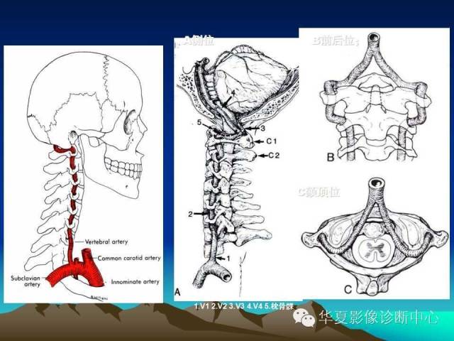【PPT】脑血管解剖