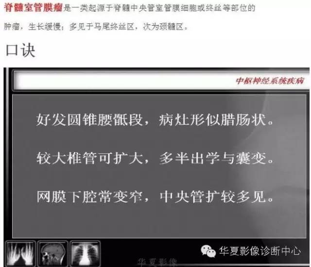 脊髓室管膜瘤的经典总结