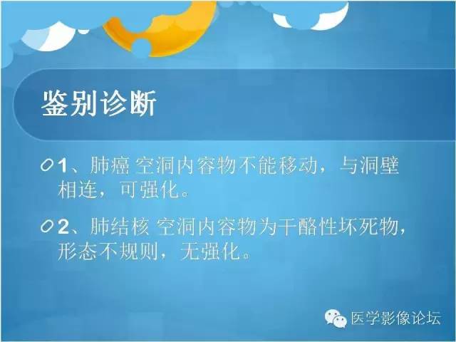 【PPT】肺曲霉菌病CT表现