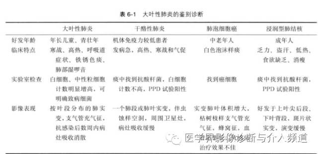 一张胸片走江湖之大叶性肺炎 一张胸片走江湖之大叶性肺炎