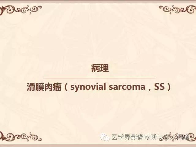 【病例】膝关节滑膜肉瘤1例MR影像表现