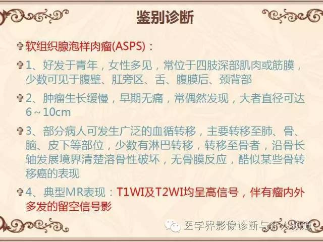 【病例】膝关节滑膜肉瘤1例MR影像表现