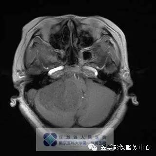 自动草稿