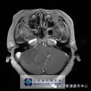 自动草稿 自动草稿