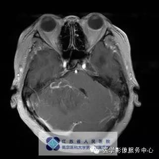 自动草稿 自动草稿