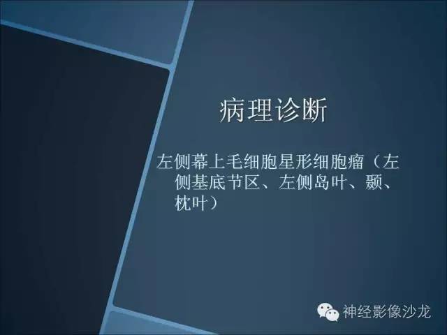 【病例】幕上毛细胞星形细胞瘤1例MR影像表现