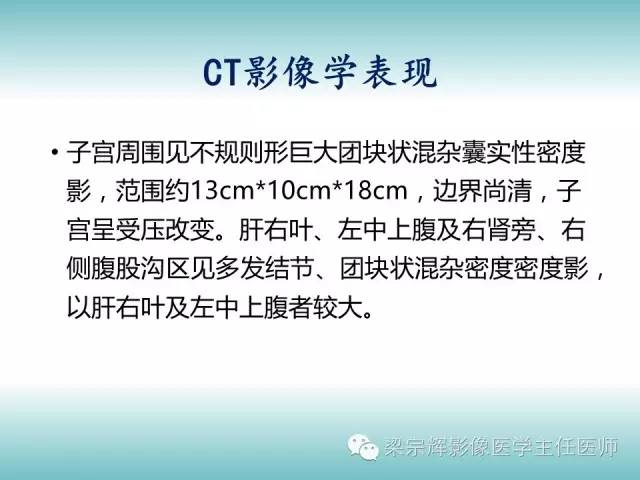 【病例】胰腺实性假乳头状肿瘤1例CT影像表现