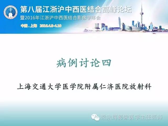 【病例】胰腺实性假乳头状肿瘤1例CT影像表现