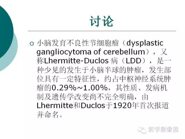 【病例】小脑发育不良性节细胞瘤1例MR影像表现